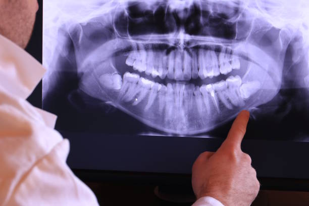 Best Emergency Cosmetic Dentistry (e.g., broken veneers) in Kensington, CT
